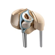 Wymiana stawu kolanowego na artretyzm